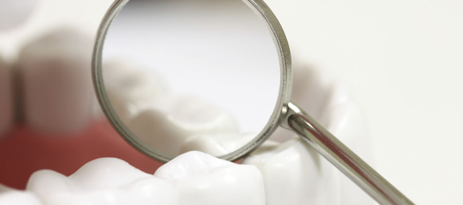 what is tooth enamel
