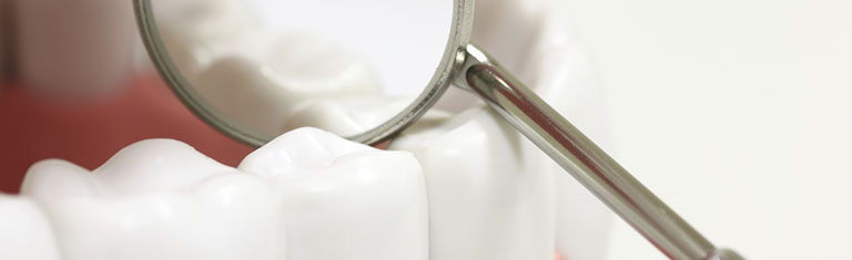 what is tooth enamel